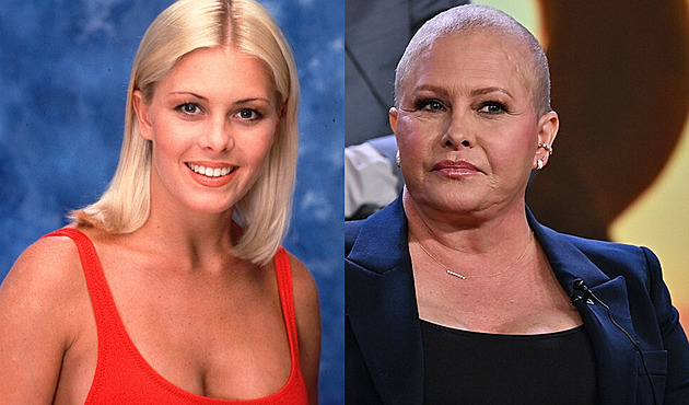 Malá prsa mi nevadí, říká po druhé mastektomii Summer z Pobřežní hlídky