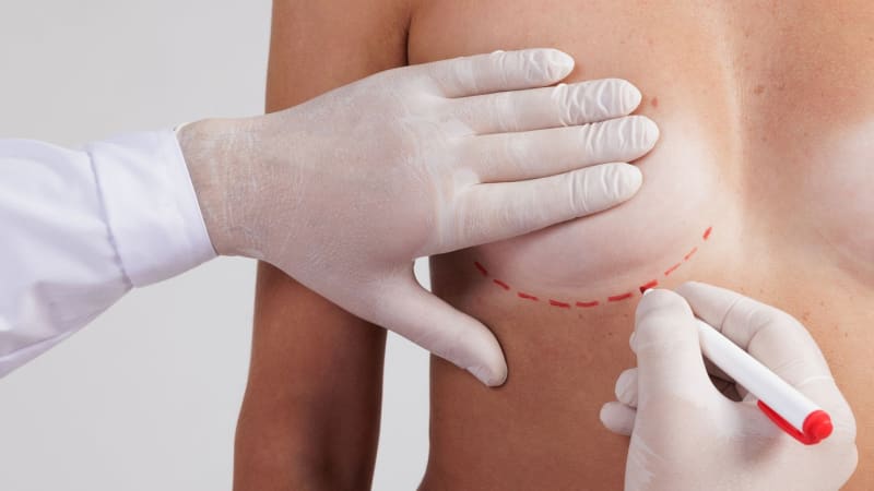 Čtrnáctiletá dívka zemřela v Mexiku při zvětšování prsou. Otec to zjistil po nahlédnutí do rakve